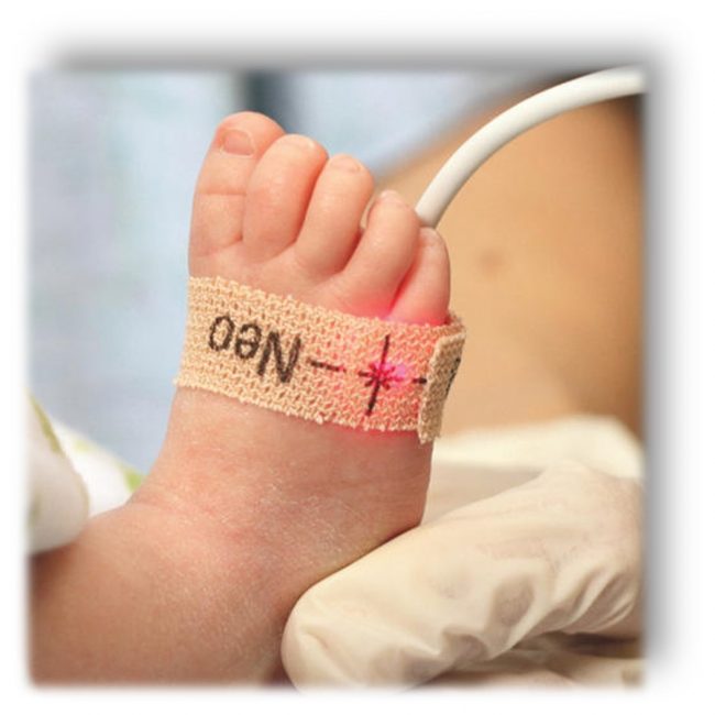 Pulsna oksimetrija kod novorođenčeta - ograničenja i greške u merenju